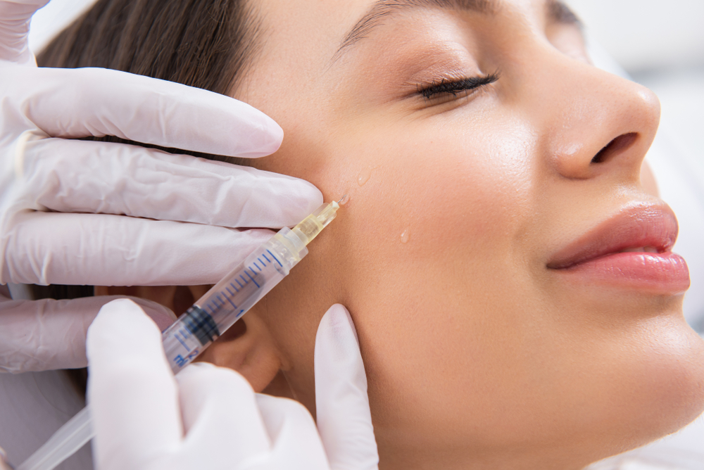 Dissolving Dermal Fillers