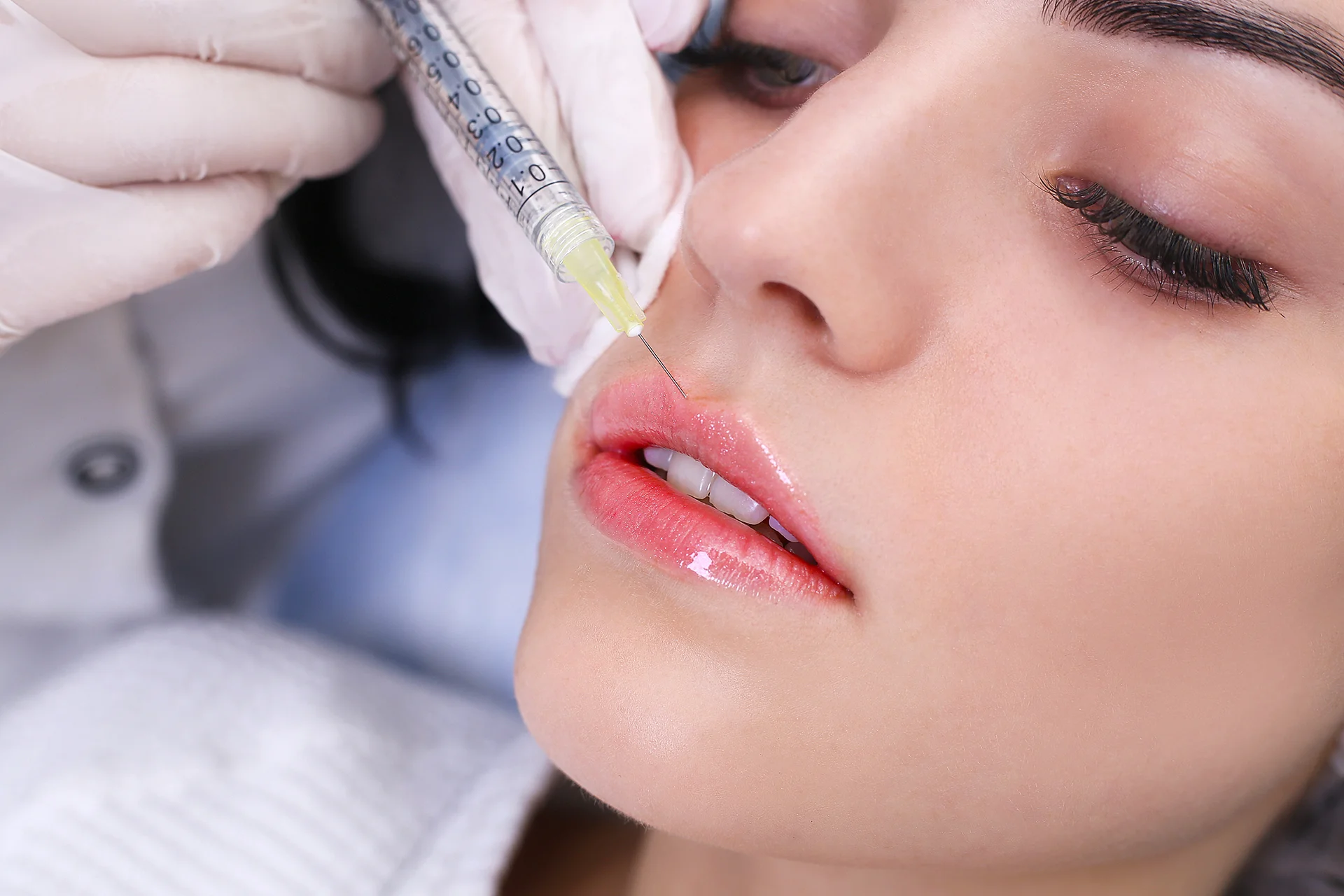Lip Filler