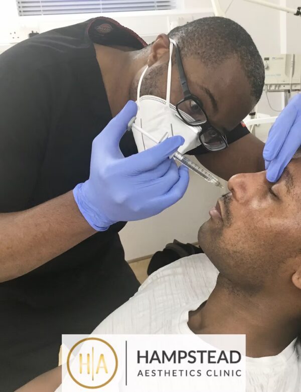 Nose Filler London (1)
