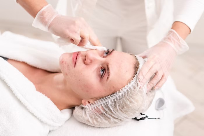 science behind ipl for acne