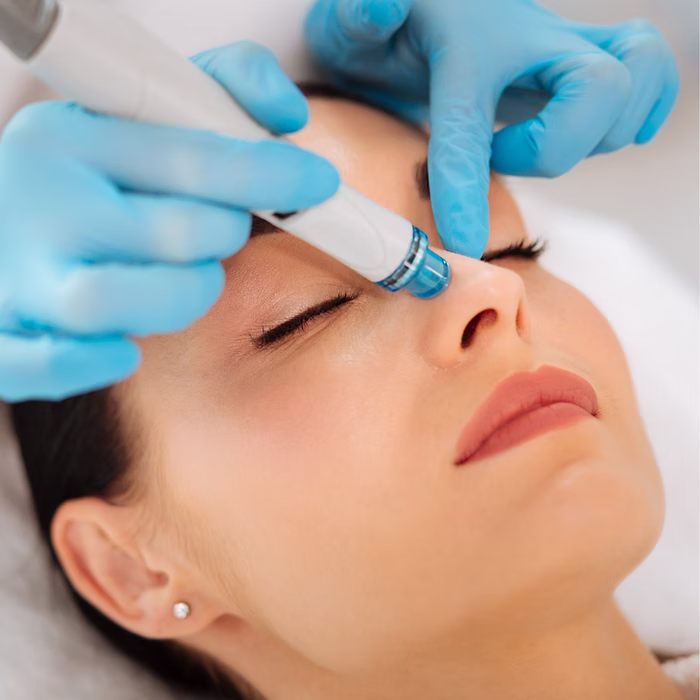 woman getting hydrofacial treatment