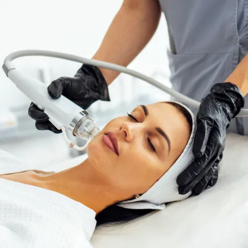 rf microneedling 4